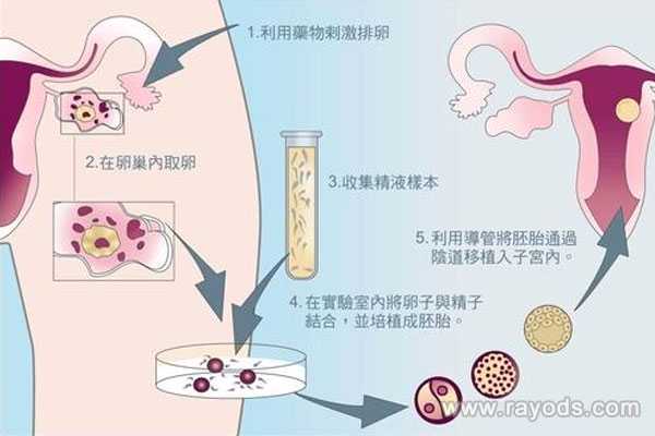 借卵子培胎_试管婴儿哪个步骤最疼_怎样治疗子宫内膜增厚
